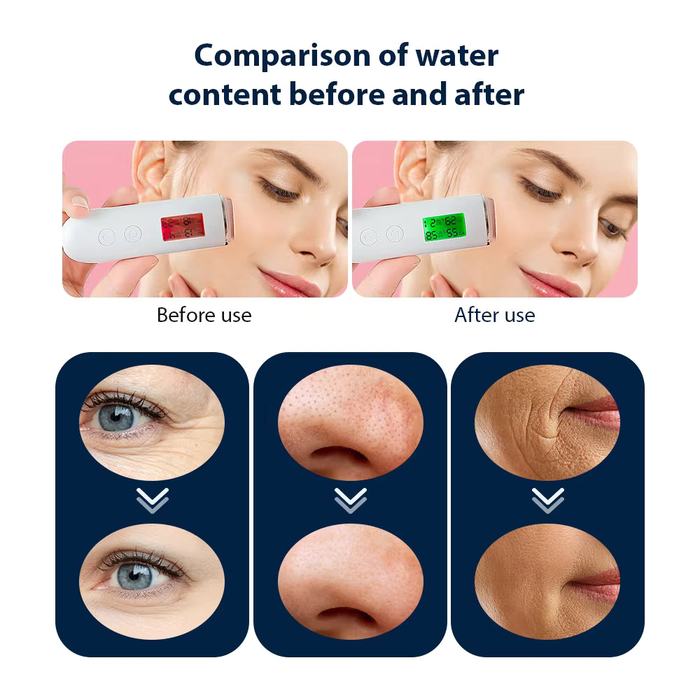 Portable CO2 Oxygen Bubble Facial Pen – Deep Cleansing & LED Light Therapy Device